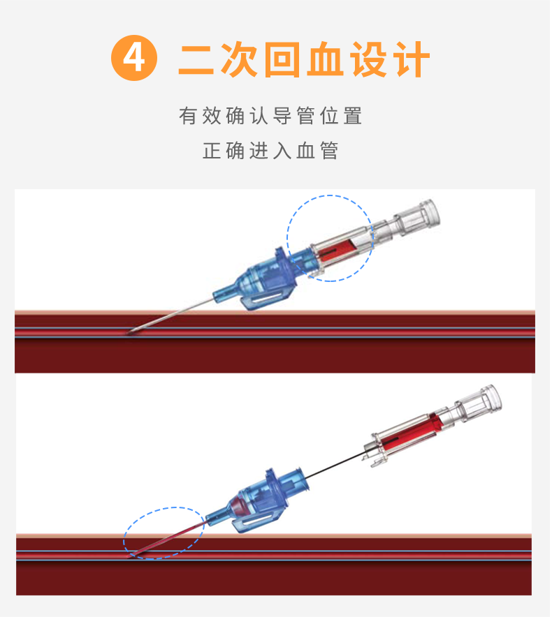 英全康22G動(dòng)靜脈留置針